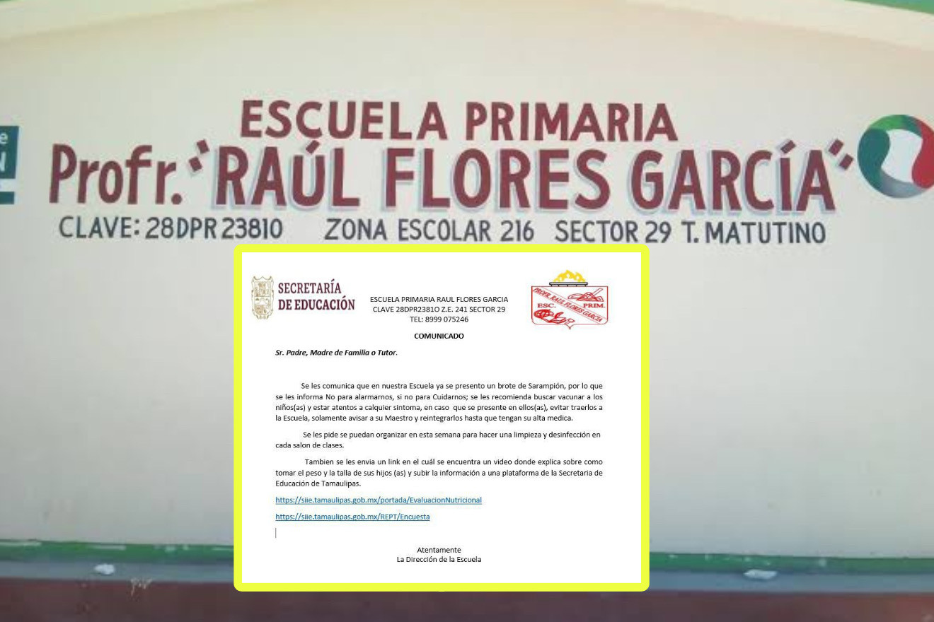 Confirman dos casos sospechosos de sarampión en Reynosa