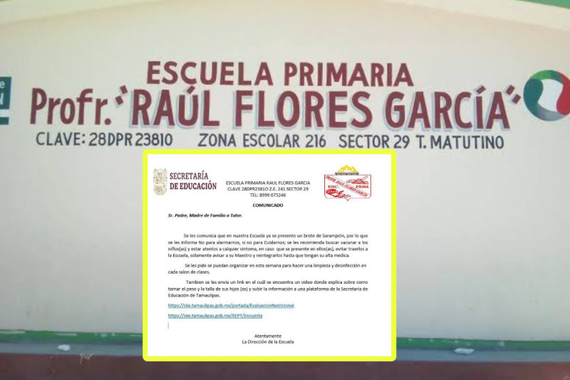 Confirman dos casos sospechosos de sarampión en Reynosa