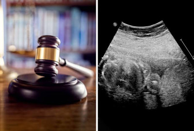 SCJN declara inconstitucionales normas que penalizaban el aborto en Tamaulipas