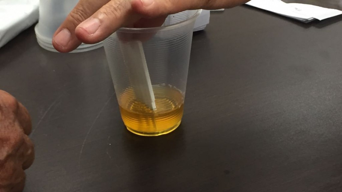 Realizan examen antidoping a chóferes en la zona sur del estado