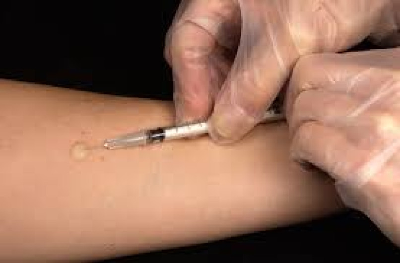 Hombre de tercera edad padece de tuberculosis