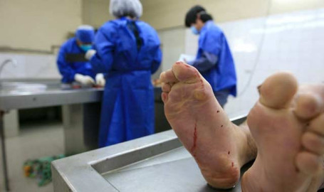 Suspenden de funciones a Perito Médico