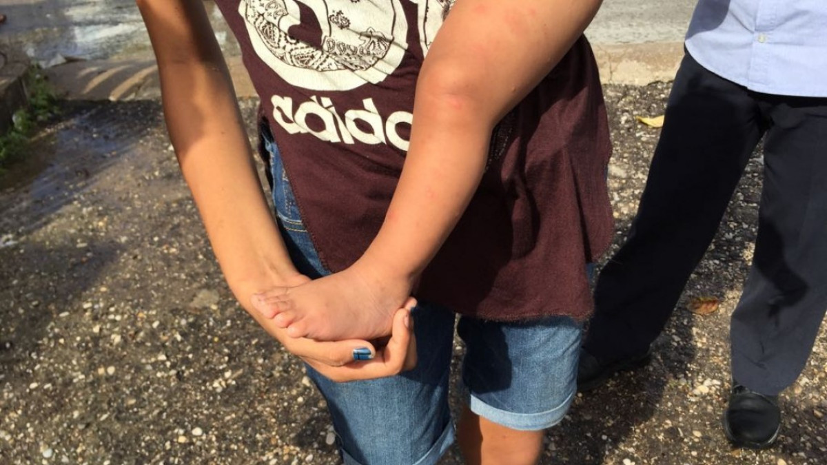 Surgen brotes de infección en la piel, tras inundaciónes