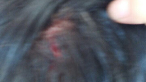 Niña se abre la cabeza con imagen de la virgen