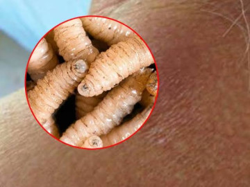 Confirman primer fallecimiento por gusano barrenador; Ssa aclara murió por complicaciones oncológicas