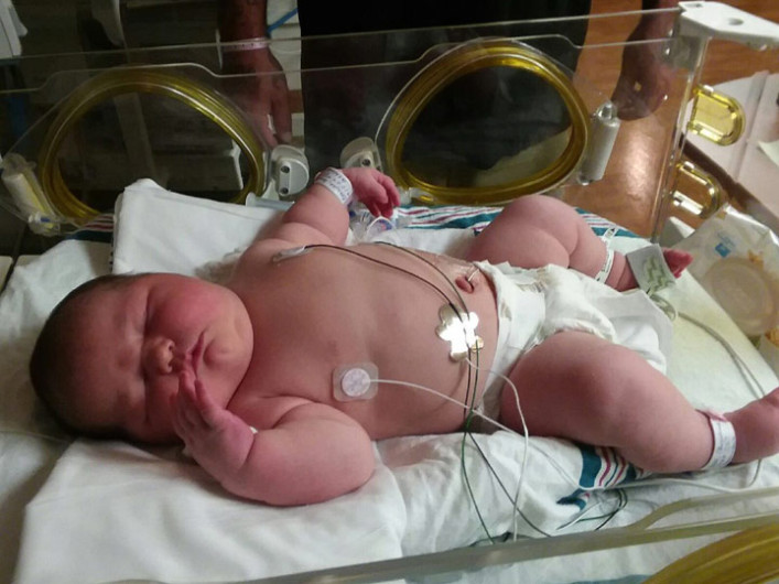 Nace enorme niña pesando 6 kilos