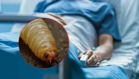 EU confirma primer caso humano de gusano barrenador en su territorio