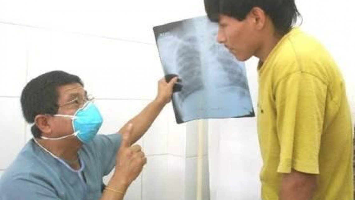 Dan seguimiento a enfermos que padecen tuberculosis pulmonar