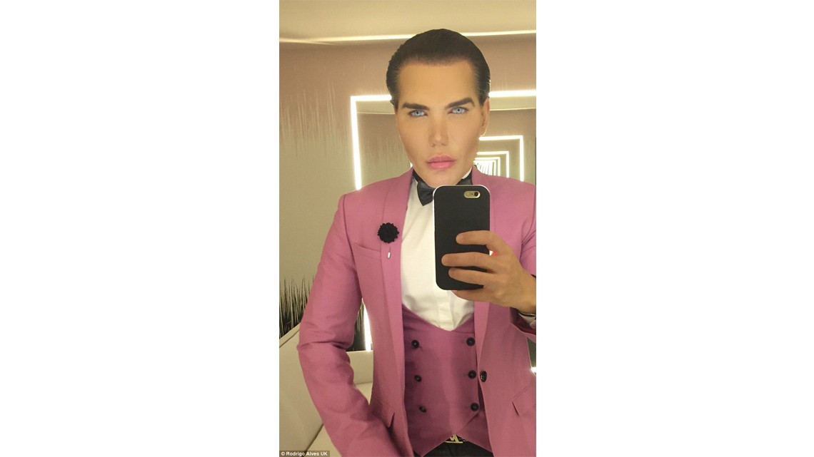 El "Ken humano" tiene complicaciones para respirar