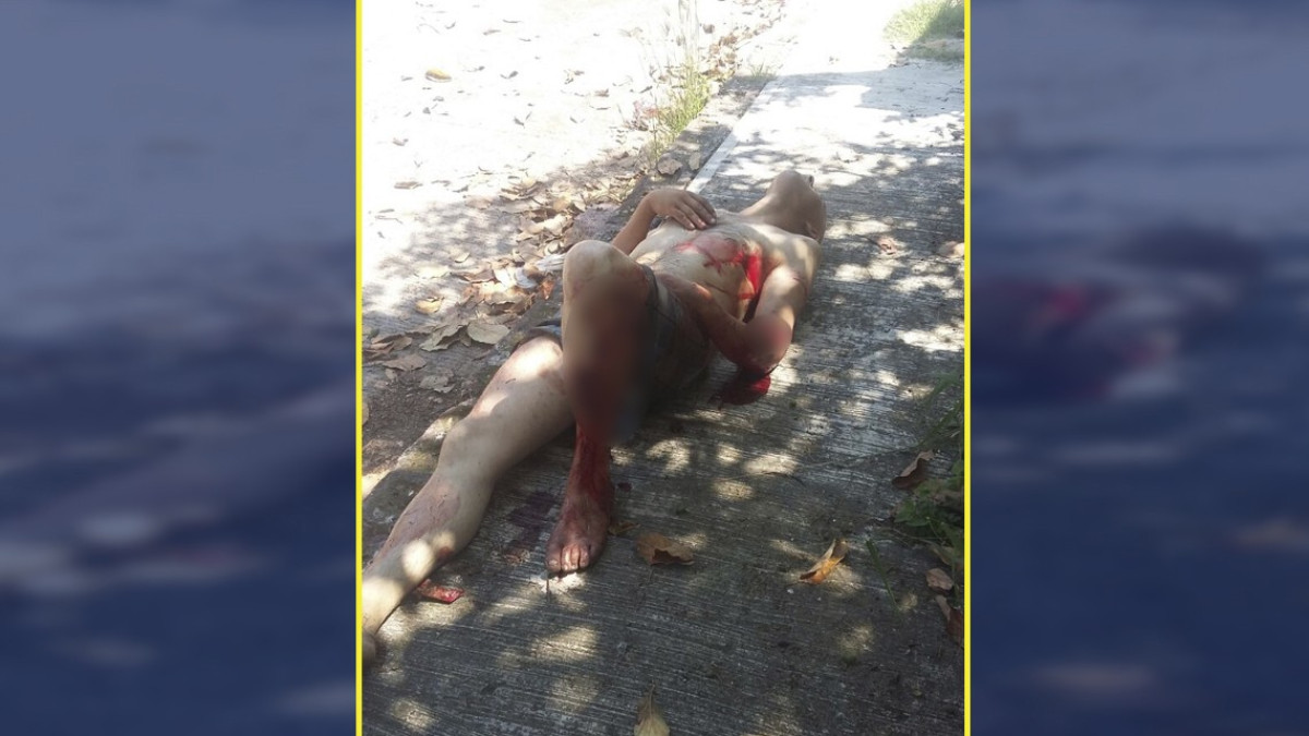 Cocodrilo ataca a un hombre en la laguna del Carpintero