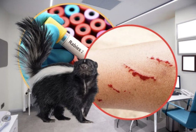 Confirman en Zacatecas primer caso de rabia humana en casi cuatro décadas