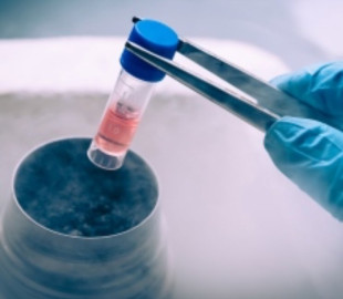 Logran eliminar el VIH en pacientes con trasplantes de células madre