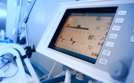 IMSS compra ventiladores más caros a hijo de Manuel Bartlett