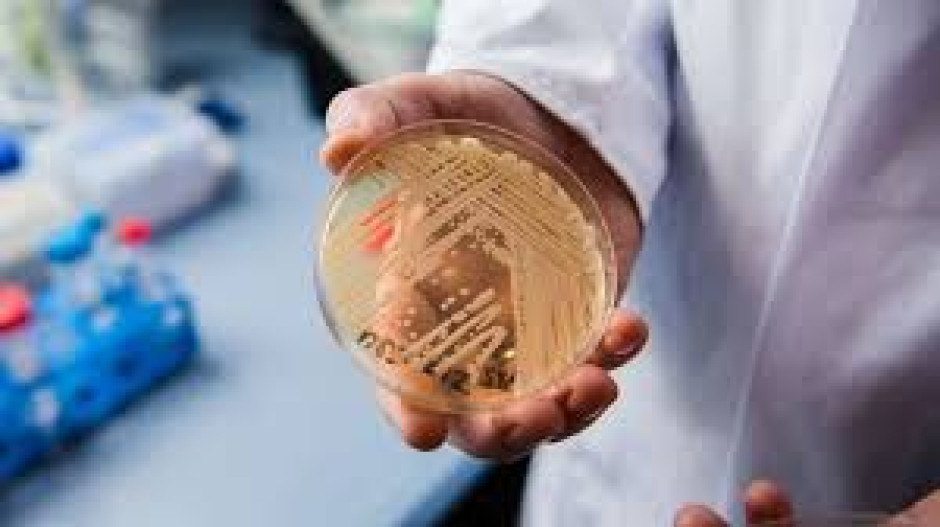 Candida auris, el hongo que tiene resistencia a medicamentos