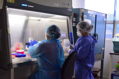 SST registra 31 nuevos casos de COVID-19 