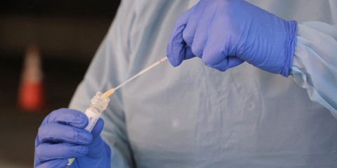 Confirman 18 casos positivos a COVID-19, suman ya 482 en el estado