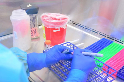 SST registra 54 nuevos casos de COVID-19 