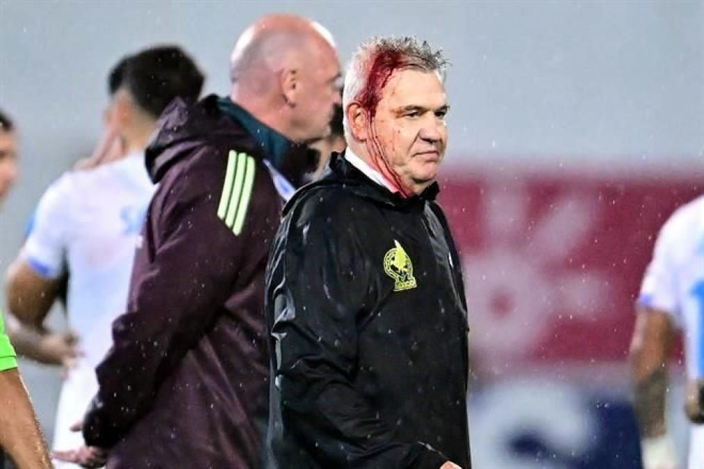 Concacaf analiza sanciones a Honduras por agresión a Javier Aguirre