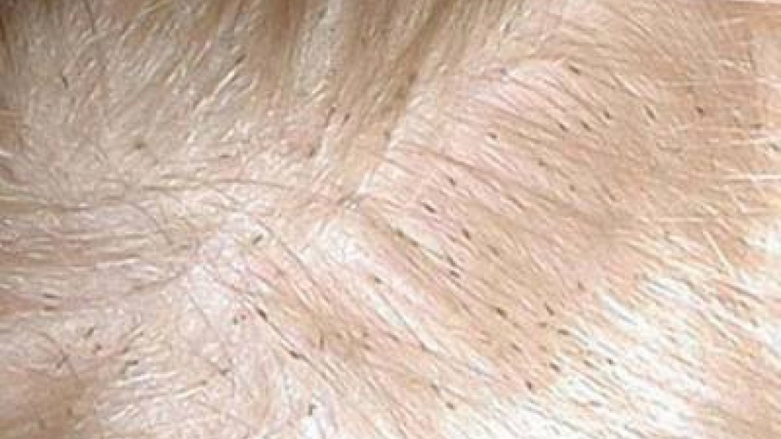 Aplican medidas para evitar la propagación de piojos en escuelas